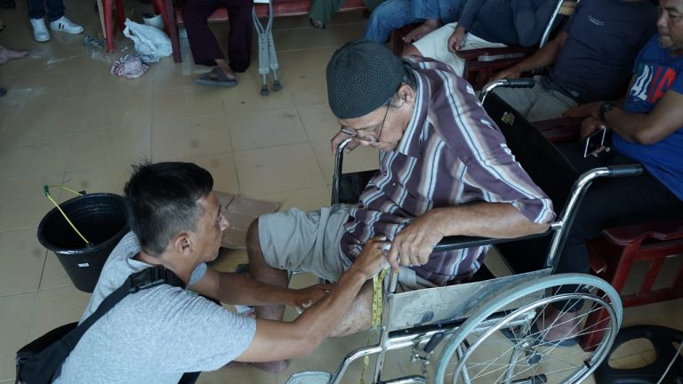 Terima Bantuan Kaki Palsu, Yunizar : Ini Sangat Berarti Bagi Kaki